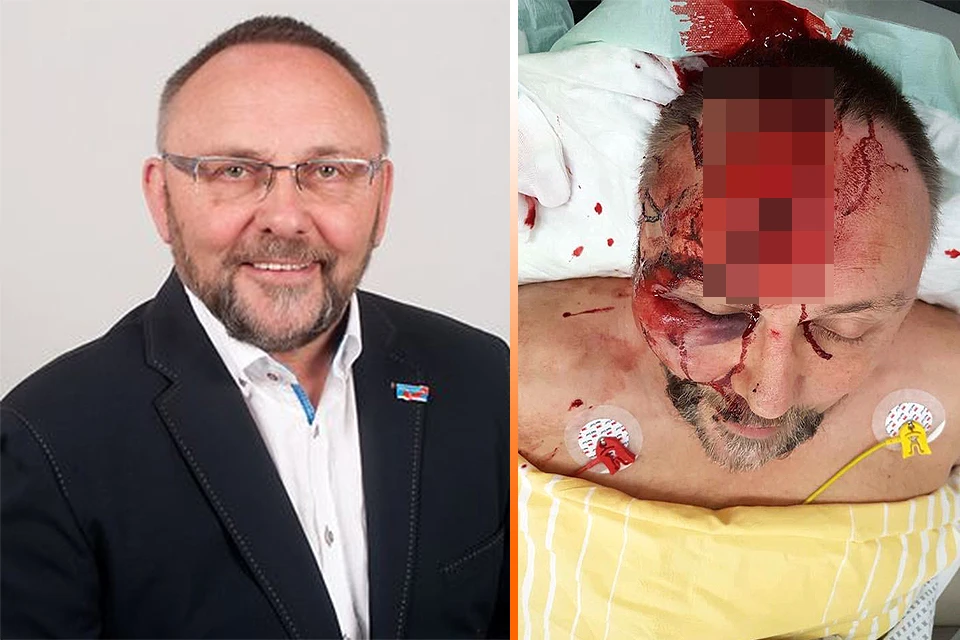 Антифашисты жестоко избили депутата от партии "Альтернатива для Германии" Франка Магница. ФОТО: Официальный сайт Бундестага / Личная страничка в соцсети