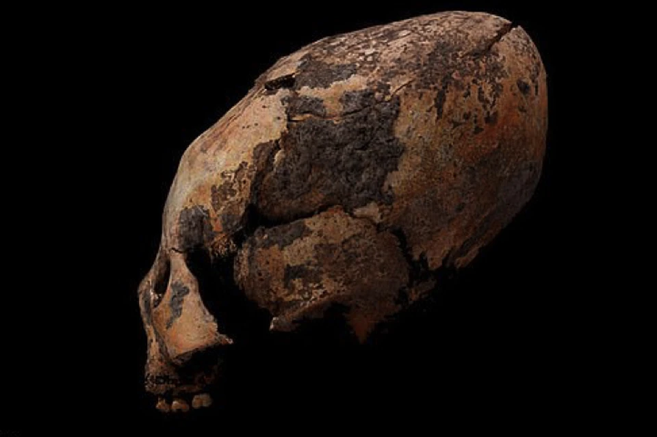 Многих наших предков не устраивали головы человеческой формы.