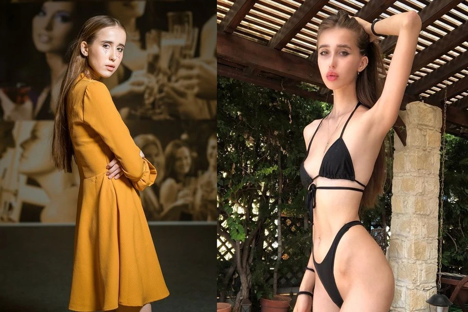 На фото слева - Катя до похудения, справа - после. Фото: соцсети/предоставлено Ириной Волчковой.