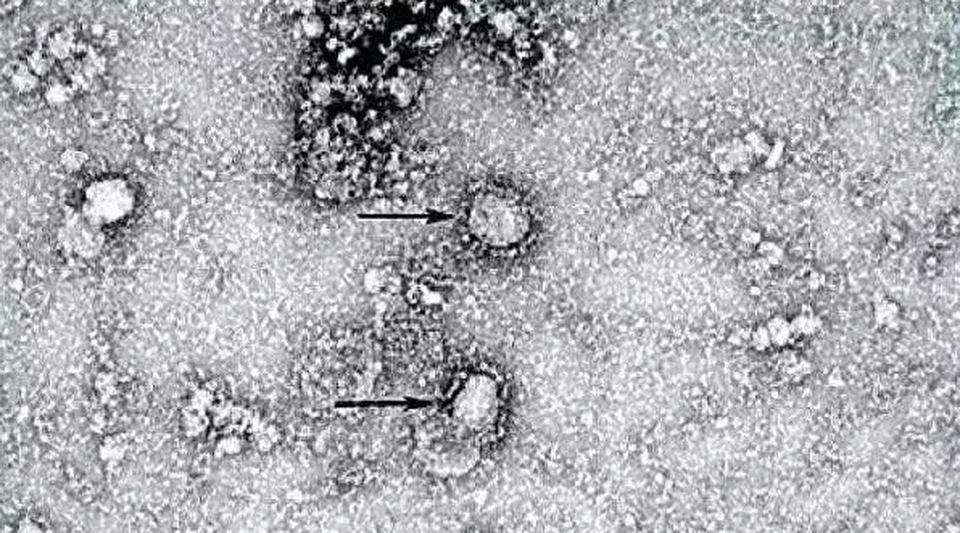 Фото: The Chinese disease prevention authority