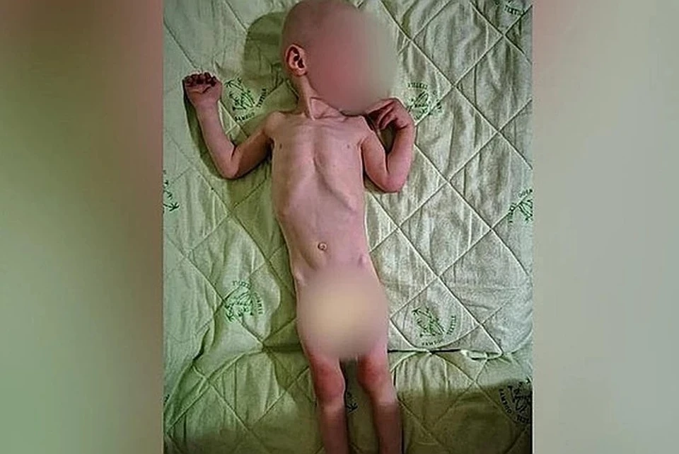 Информация о состоянии малыша привлекла внимание следователей. Фото: КРБОО «Наша надежда»/FB
