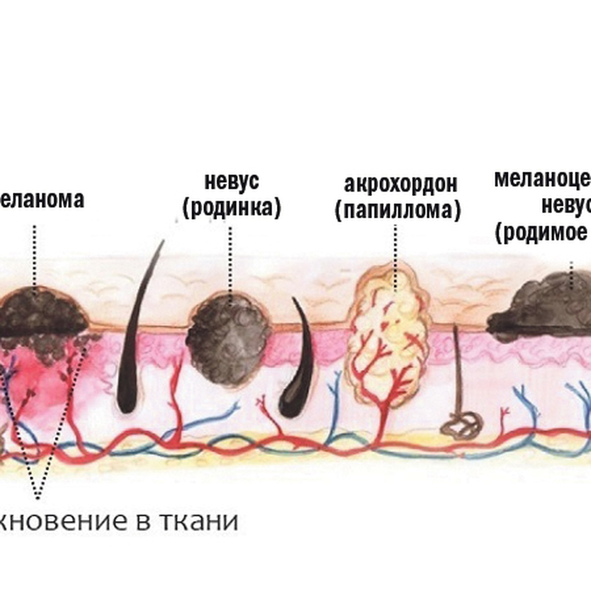 Такие разные новообразования: что нужно знать тулякам - KP.RU