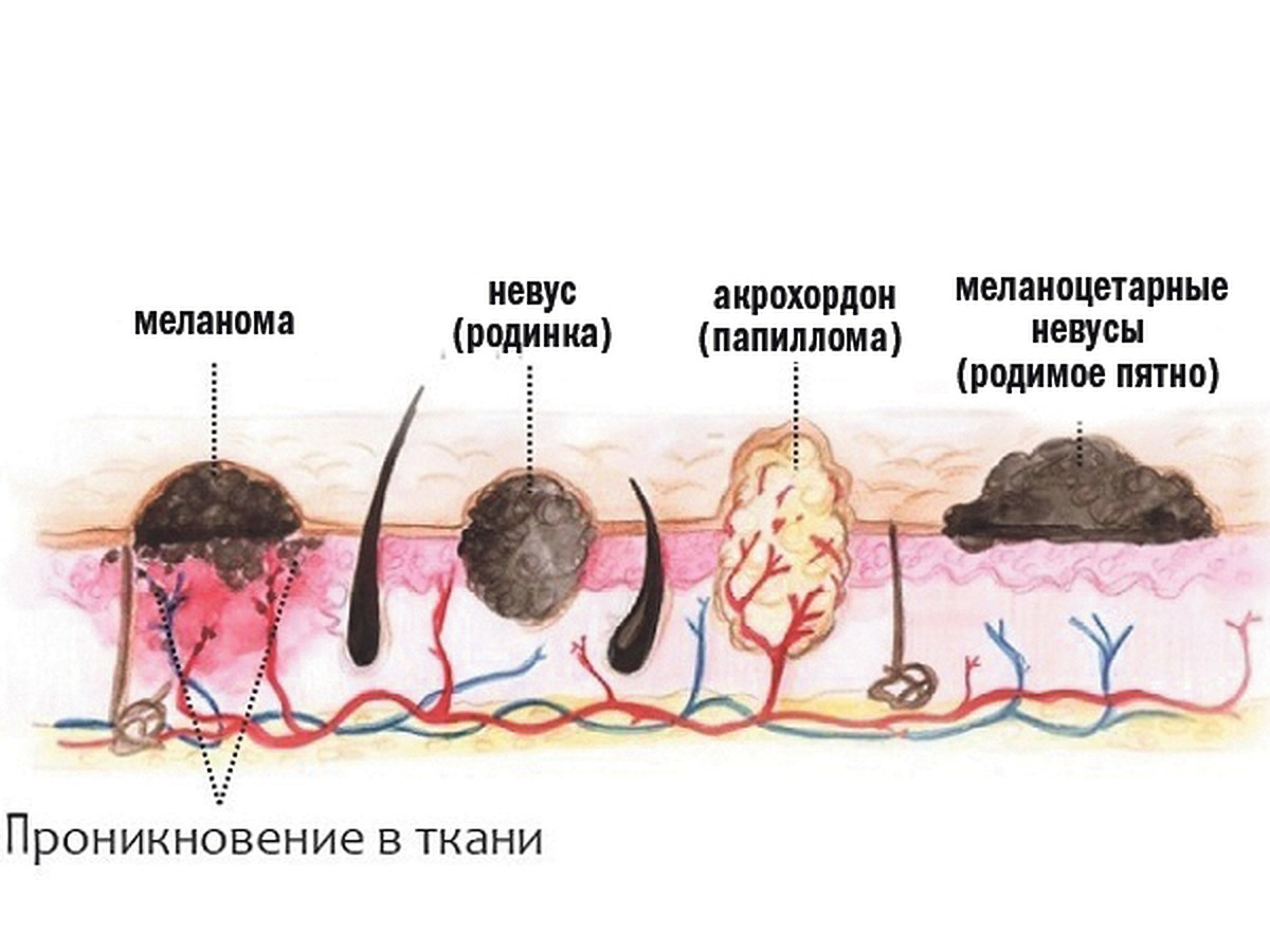 Такие разные новообразования: что нужно знать тулякам - KP.RU