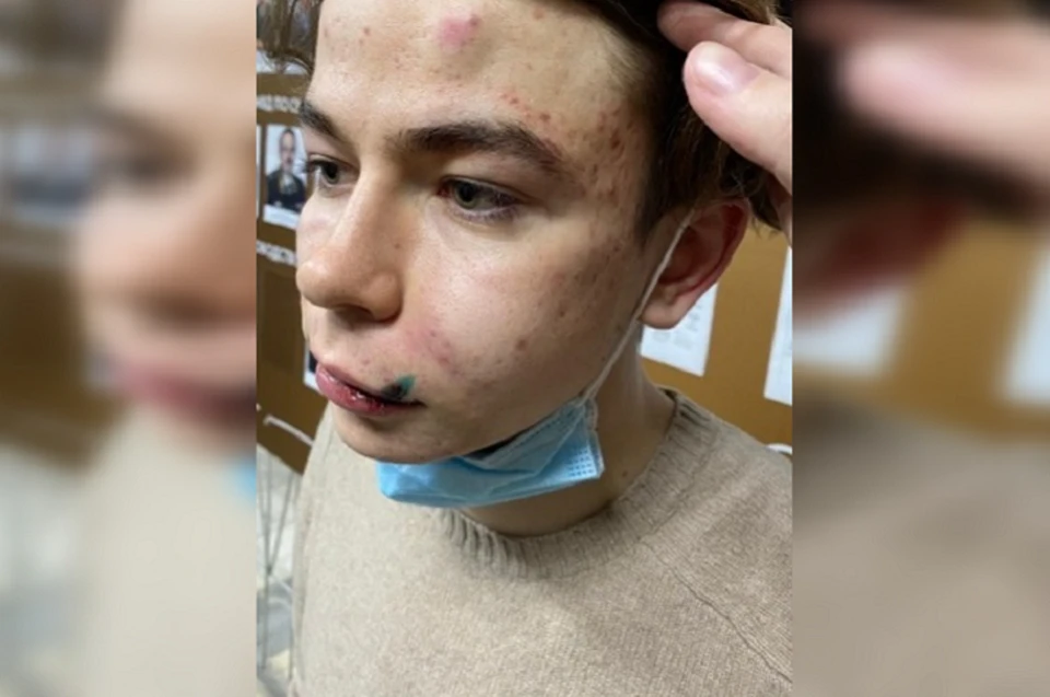 Потерпевший уже написал заявление в полицию. Фото: предоставлено героем публикации