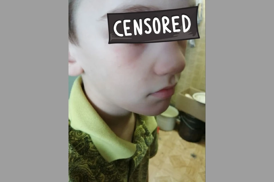 Инцидент произошел в Усть-Заостровской школе с учеников 2Б класса Степаном. Фото мальчика: «Инцидент Омск»