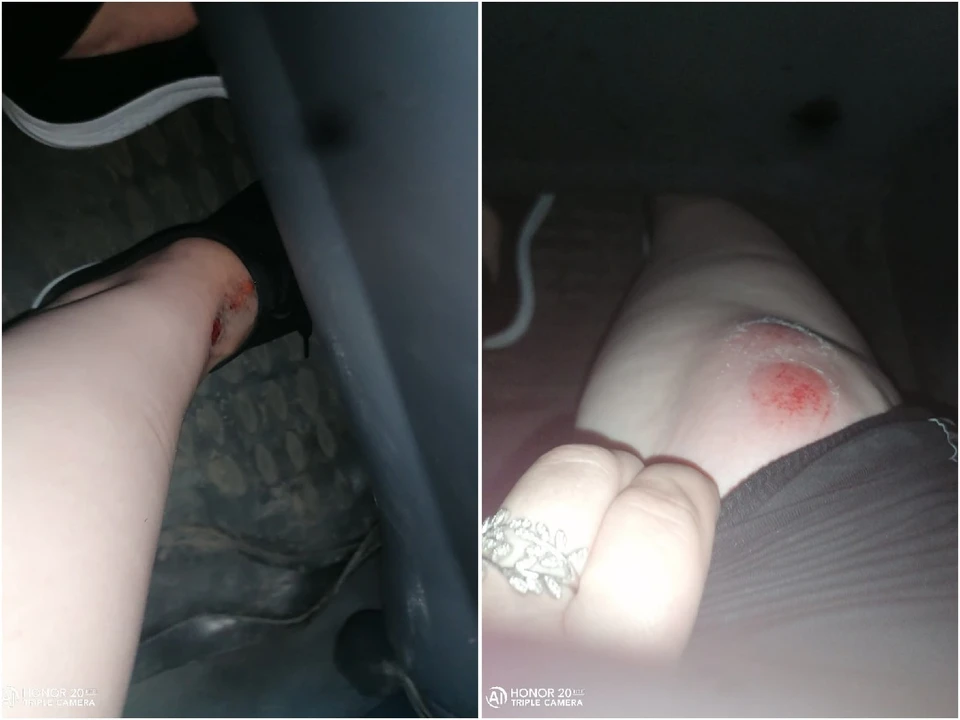 Пассажирка такси в результате происшествия содрала кожу на ноге. Фото: «Инцидент Омск»