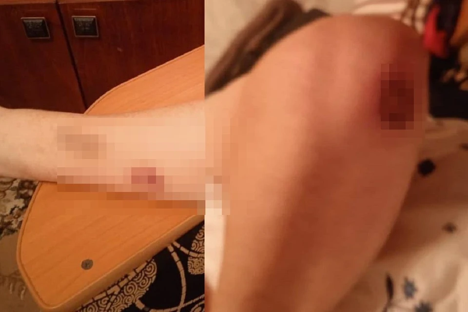 В Новосибирске пациентку с диабетом привязывали к кровати в ковидном госпитале. Фото: ACT-Black.