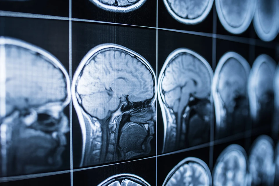 Ученые увидели в активности мозга умирающего человека попытку воспроизвести воспоминания