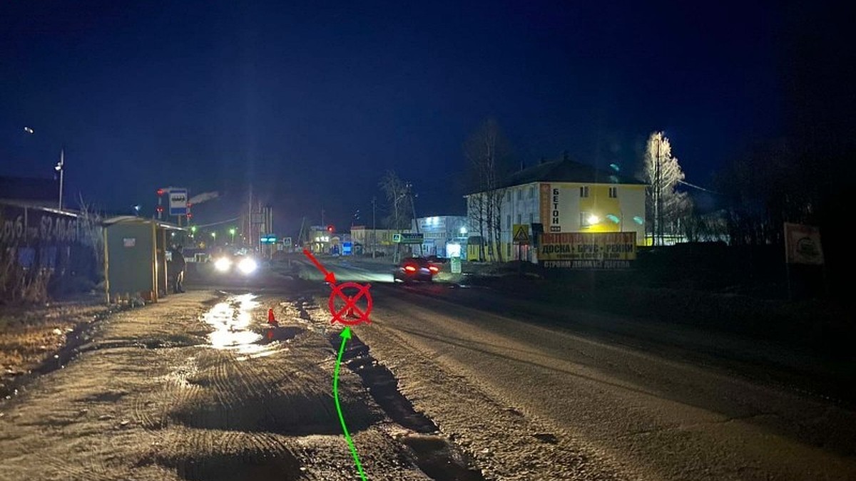 В Сыктывкаре в ДТП с грузовиком пешеход получил перелом основания черепа -  KP.RU