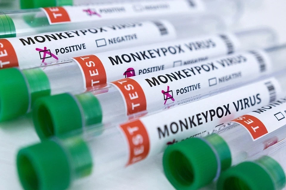 ВОЗ оценивает риск появления оспы обезьян в России как высокий