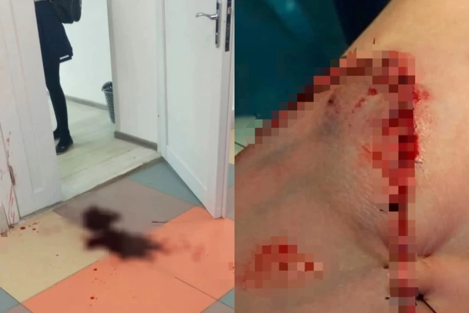 В школе под Новосибирском ученица прорвала руку дверной ручкой. Фото: Инцидент Новосибирск.