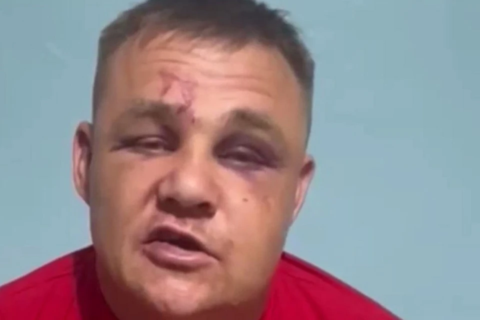 Бойца СВО, которого избили в Забайкалье, выписали из больницы