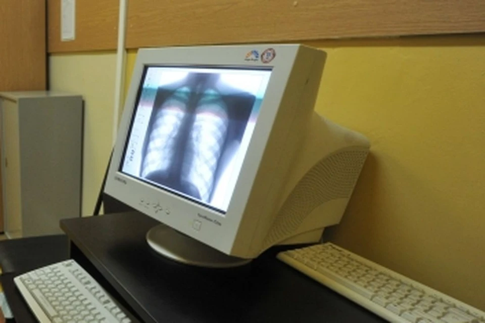 Новосибирцы смогут бесплатно пройти обследование на туберкулез