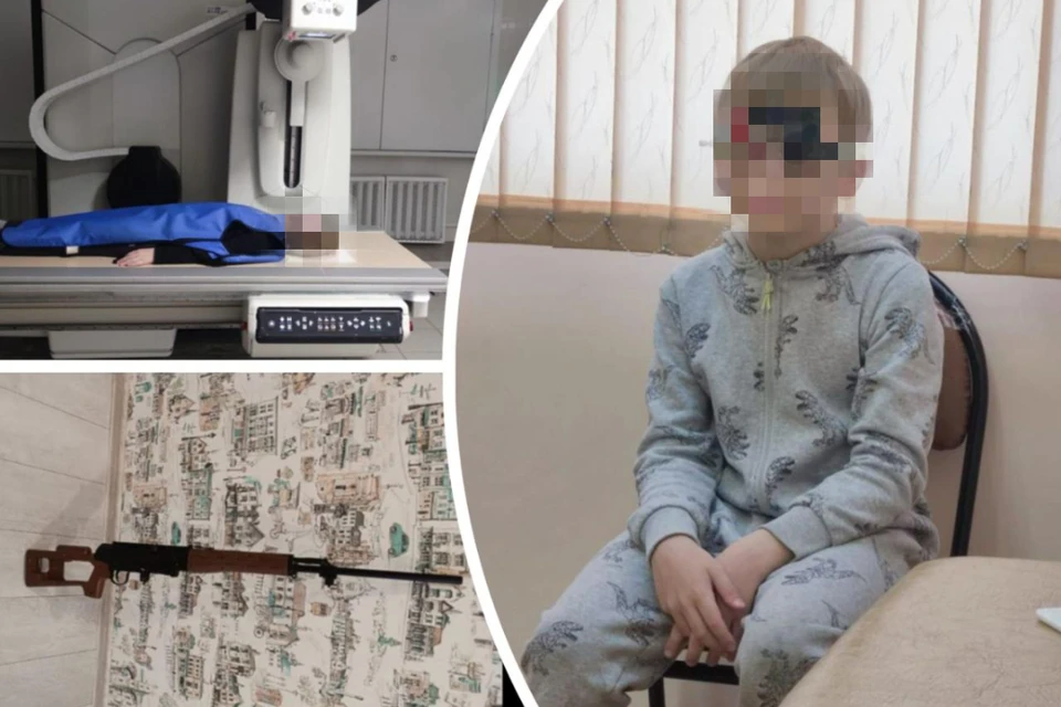 Сверстник выстрелили мальчику в лицо и он почти перестал видеть левым глазом. Фото: Предоставлено мамой пострадавшего