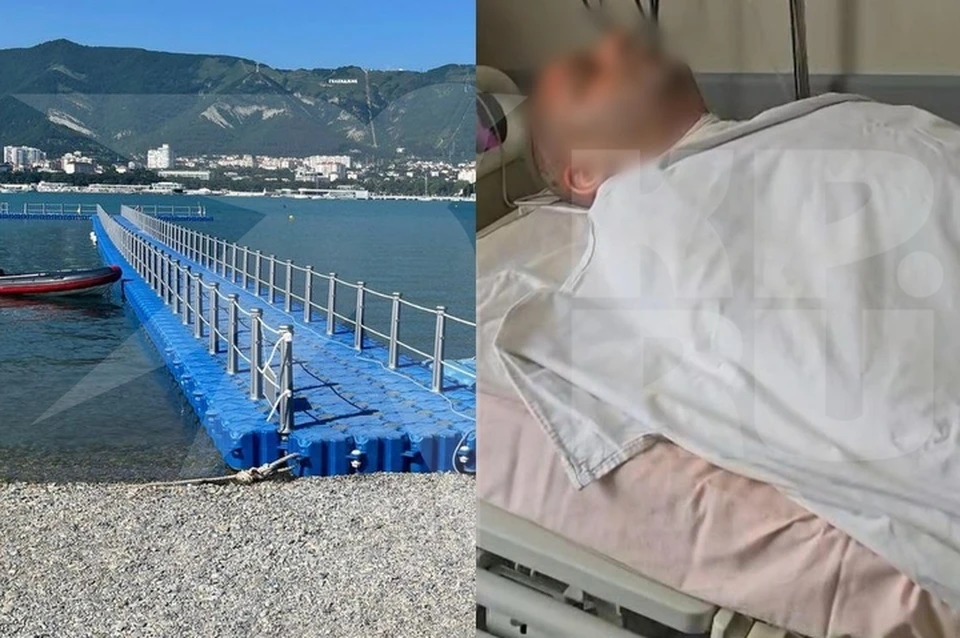 Мужчина находится в больнице с ожогами