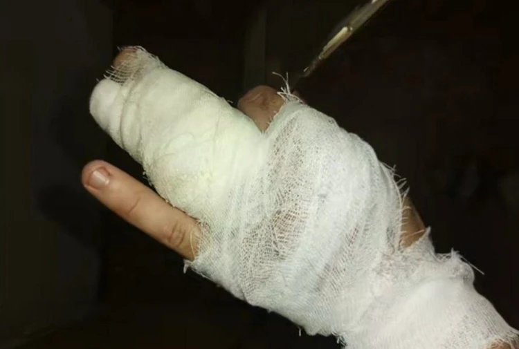 В Кишиневе пассажиры пырнули таксиста ножом, чтобы не платить за поездку: Полиция ищет преступников