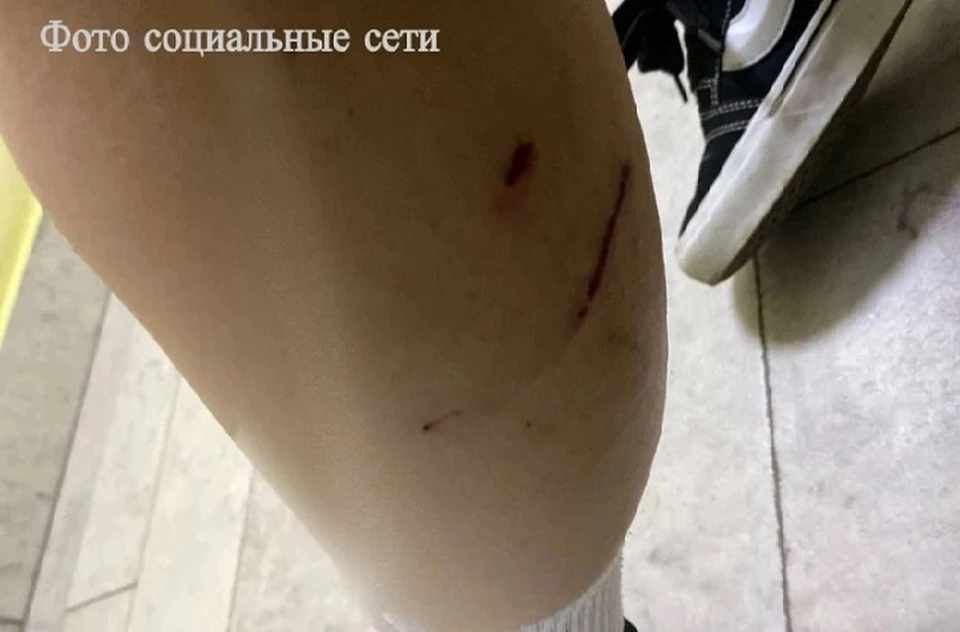 Собаки покусали подростка в Минводах. Фото: социальные сети, предоставлено СК