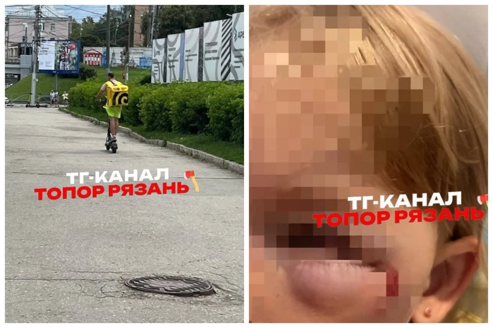 Курьер на элекросамокате сбил девочку в Рязани и скрылся. Фото подписчика канала «Топор | Новости Рязани»