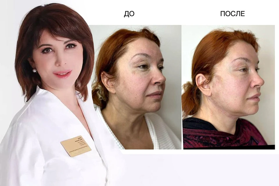 Зухра Амин и ее пациентка - актриса Вера Сотникова.