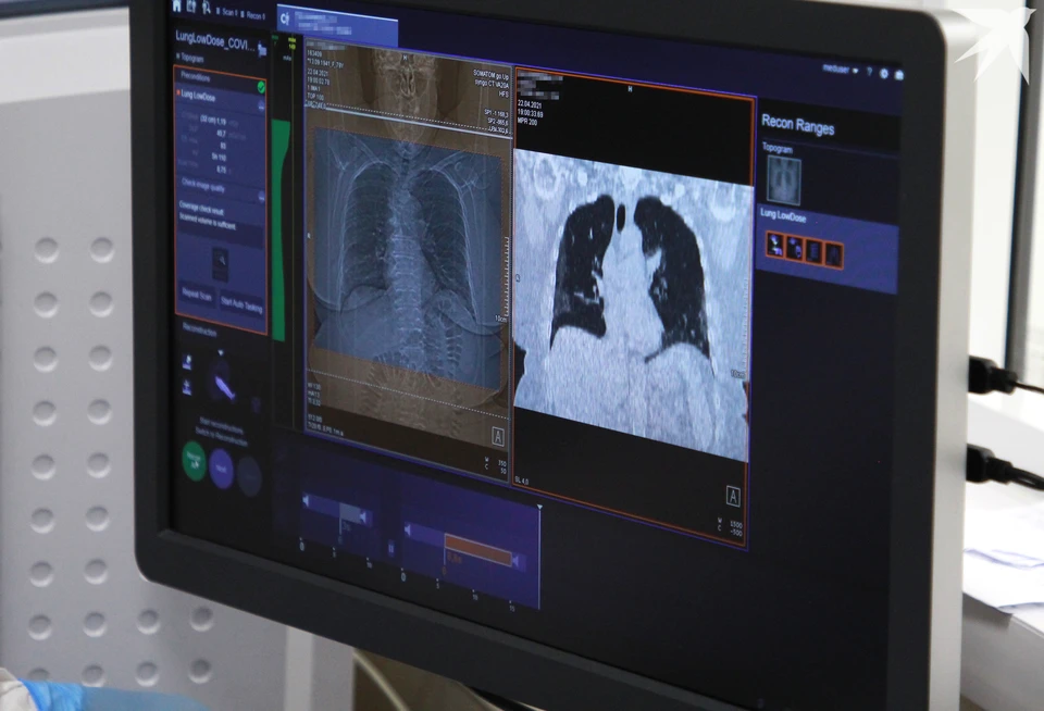 В Мурманской области в 2024 году впервые выявлено 358 случаев рака легких, в том числе 238 случаев - у мужчин и 120 случаев - у женщин.