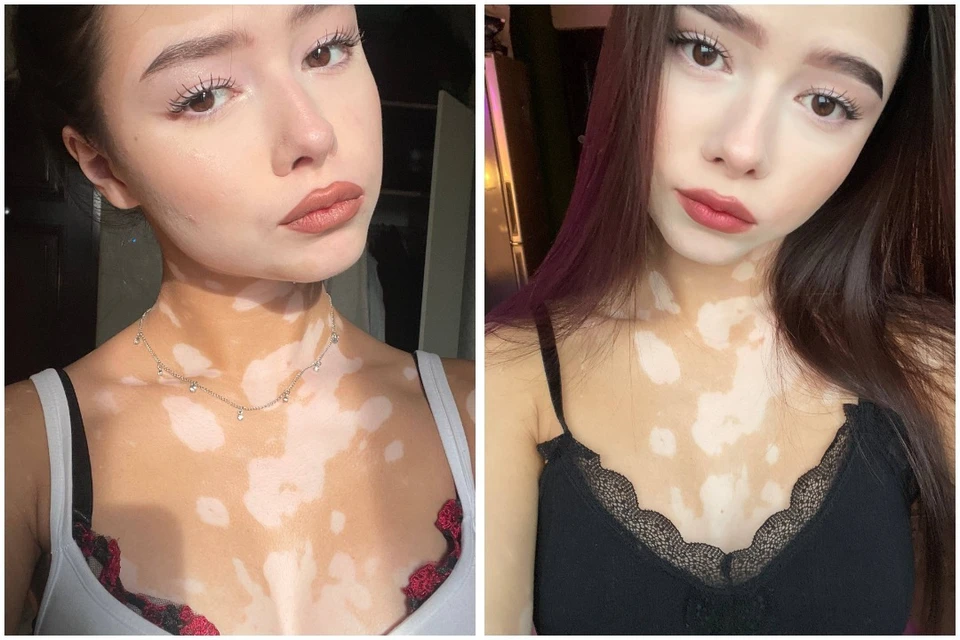 18-летняя Карина Гуреева из Иркутска давно свыклась с удивленными взглядами окружающих. Фото: личный архив героини публикации