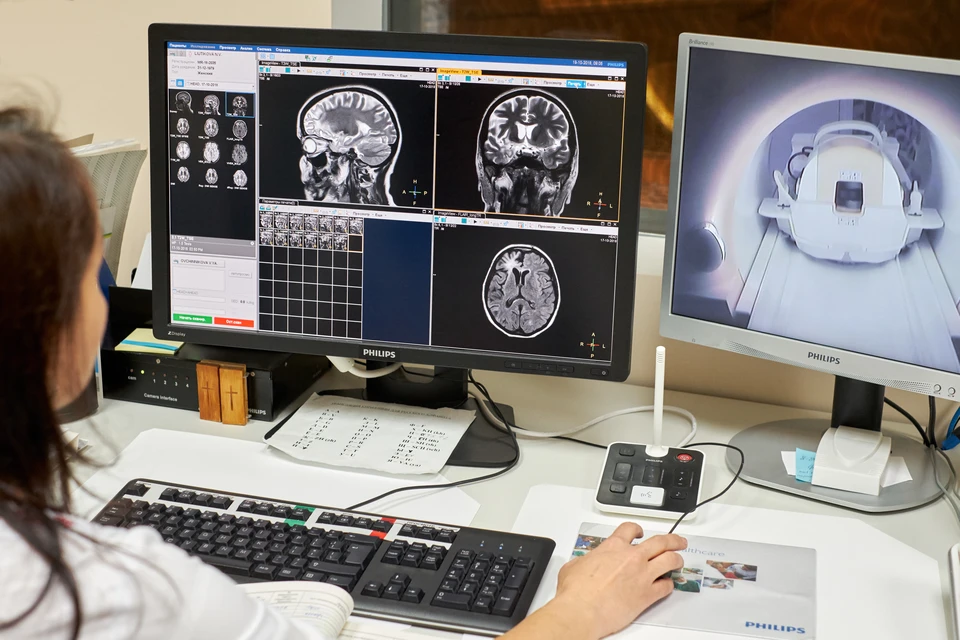 У пациентки диагностировали тромбоз венозных синусов - самый редкий вид инсульта