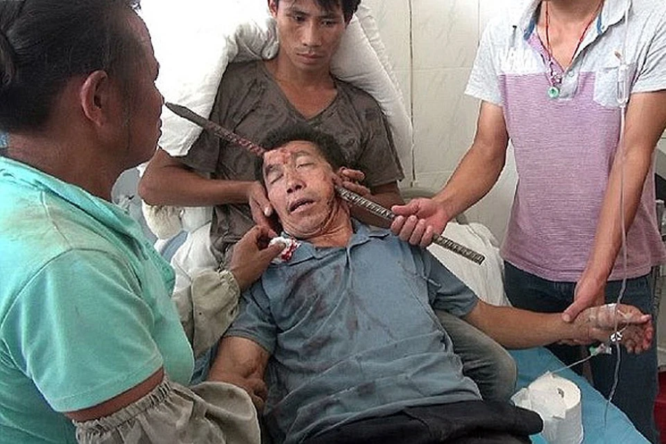 Китаец, разбиравший дом, пробил металлическим стержнем голову, но выжил