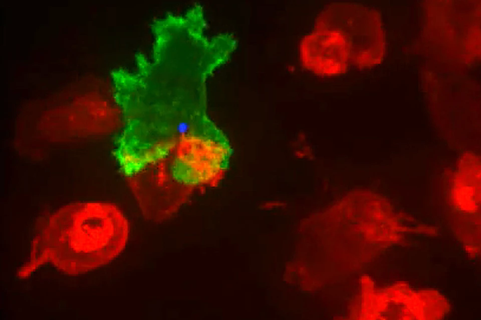 Ученые сняли на видео битву иммуной системой и раковых клеток