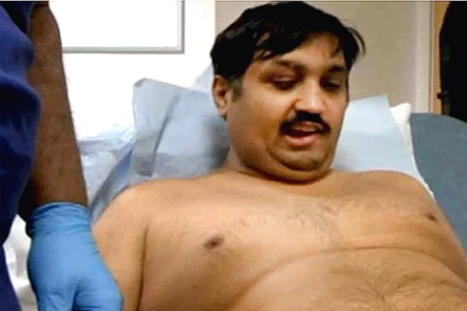 Мужчине, потерявшему пенис в аварии, вживили полнофункионирующий био-протез длиной 20 см. Фото: кадр из Youtube