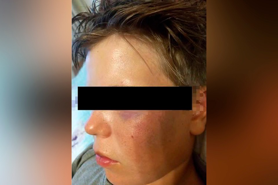 Девятилетнего Ивана много дней избивали толпой за то, что он русский и православный. Фото: 24.kg