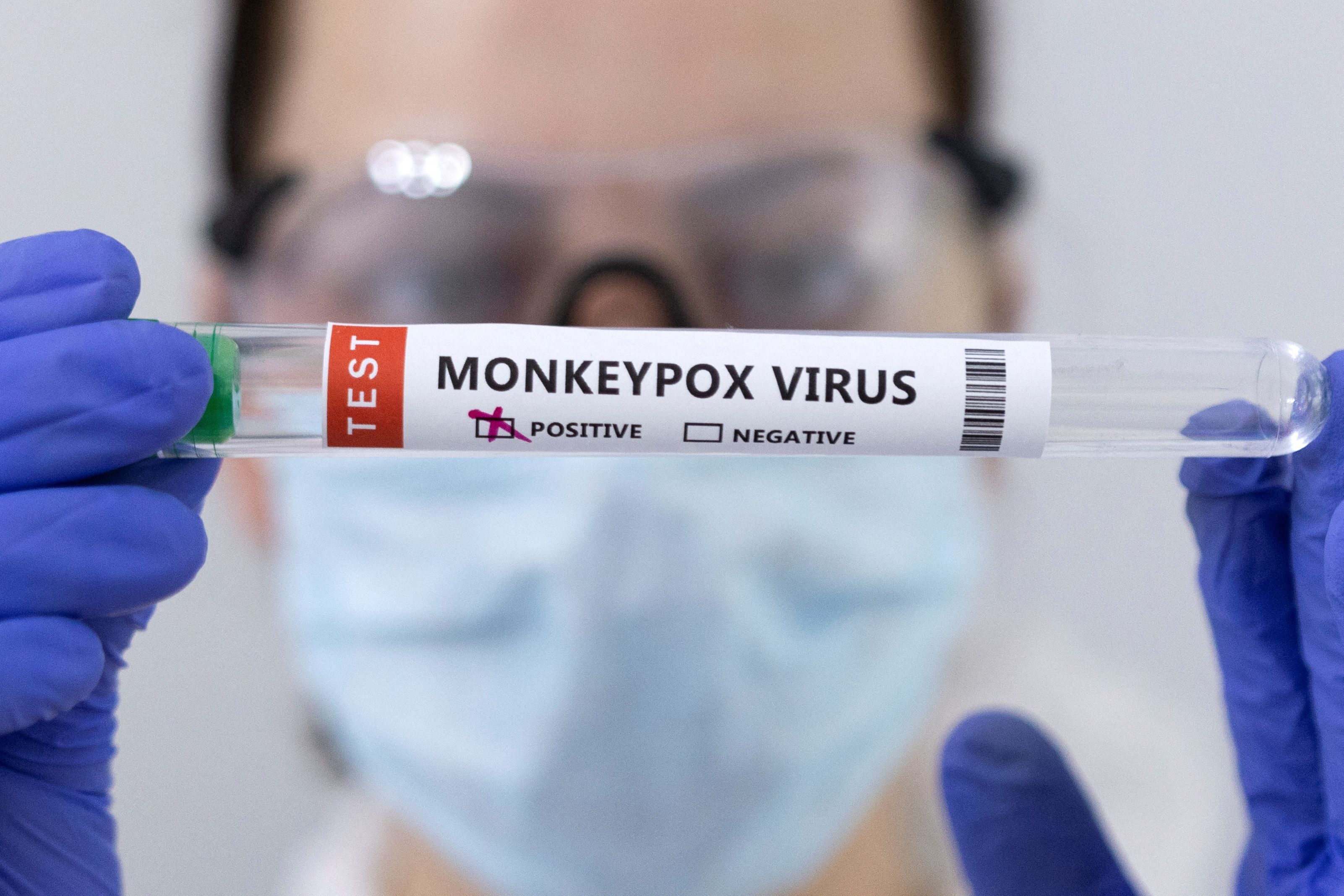 Dnes mají epidemiologové podezření: opičí virus se možná naučil o něco efektivněji přeskakovat z nakažených lidí na nové oběti.